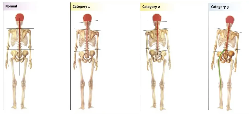 Diagram of SOT categories